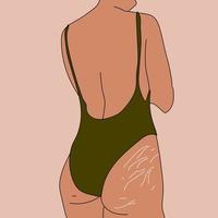 Woman with stretch marks . Self love and body positive concept. Vector illustration in flat style