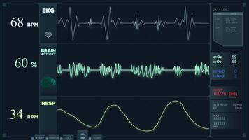 Animation of an electrocardiogram display reading in normal mode. EEG and EKG video