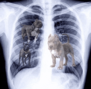 an x-ray of a person 's chest with three puppies standing inside