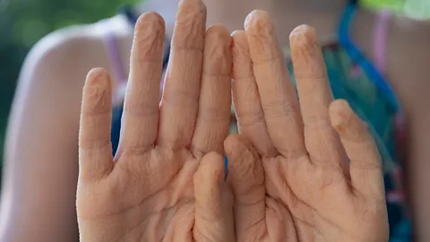 Wrinkly fingers from being in water