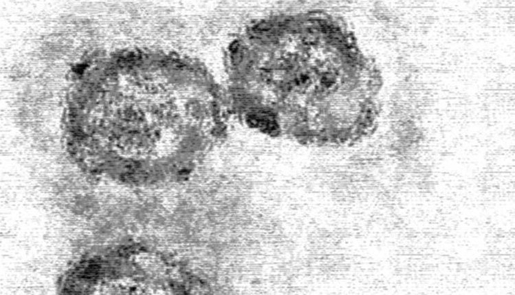 Micrografía electrónico de virus de la hepatitis C. 