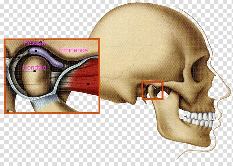 Temporomandibular joint dysfunction Mandible Jaw, others.