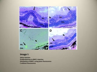 Image I:Saline injectionProliferated due to BMC’s injectionDistribution of BMC’s using green fluorescenceC without Flourescence