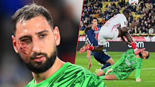 Wilfried Singo (23) trifft PSG-Keeper Gianluigi Donnarumma (25) mit den Stollen im Gesicht