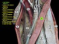 Sartorius muscle