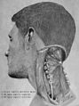 Obliquus capitis inferior's relationship to other suboccipital muscles.