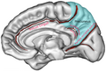 Boundaries of precuneus are defined by the three sulci. (shown in red) marginal branch of the cingulate sulcus parieto-occipital sulcus subparietal sulcus The area colored blue represents parietal lobe.