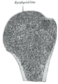 Longitudinal section of head of left humerus.