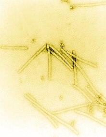 Transmission electron micrograph of TMV particles negative stained to enhance visibility at 160,000× magnification