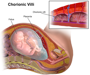 Chorionvilli