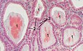 Thyoid histology