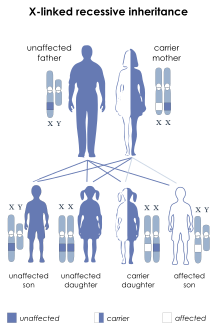 X-link recessive inheritance