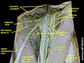 Sartorius muscle