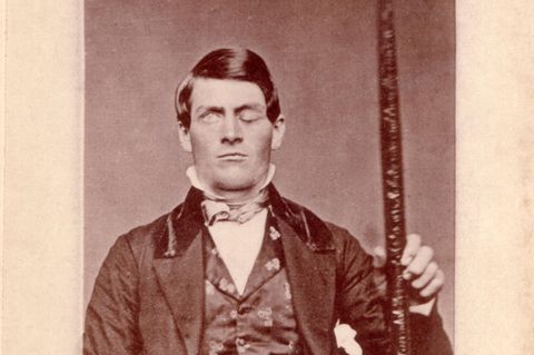 Phineas Gage