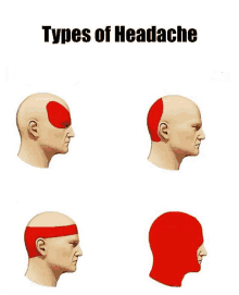 four types of headache are shown with a red head