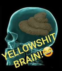 an x-ray of a skull with a pile of poop in it and the words yellowshit brain