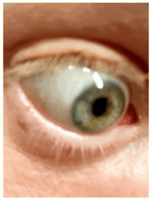 a close up of a person 's green eye with a red pupil