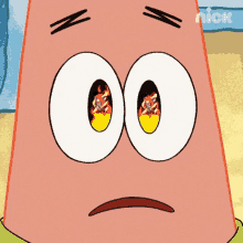 patrick star from spongebob squarepants has a sad look on his face and his eyes are burning