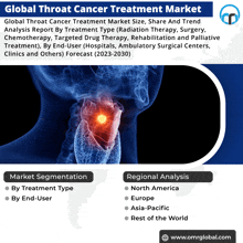 global throat cancer treatment market analysis report by treatment type radiation therapy surgery chemotherapy targeted drug therapy rehabilitation and palliative treatment