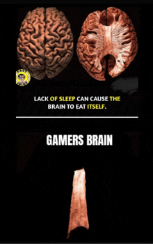 a poster that says lack of sleep can cause the brain to eat itself on it