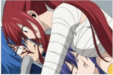 a couple of anime characters , one of which is a girl with red hair and bandages on her arm .