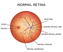 Global Diabetic Retinopathy Market Meme