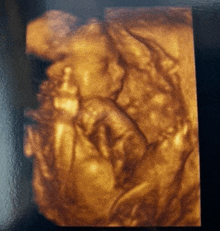 an ultrasound image of a baby 's face