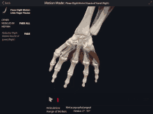 a screen shows a skeleton of a hand and says motion mode at the top