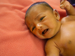 Upset baby with jaundice lying on an orange sheet