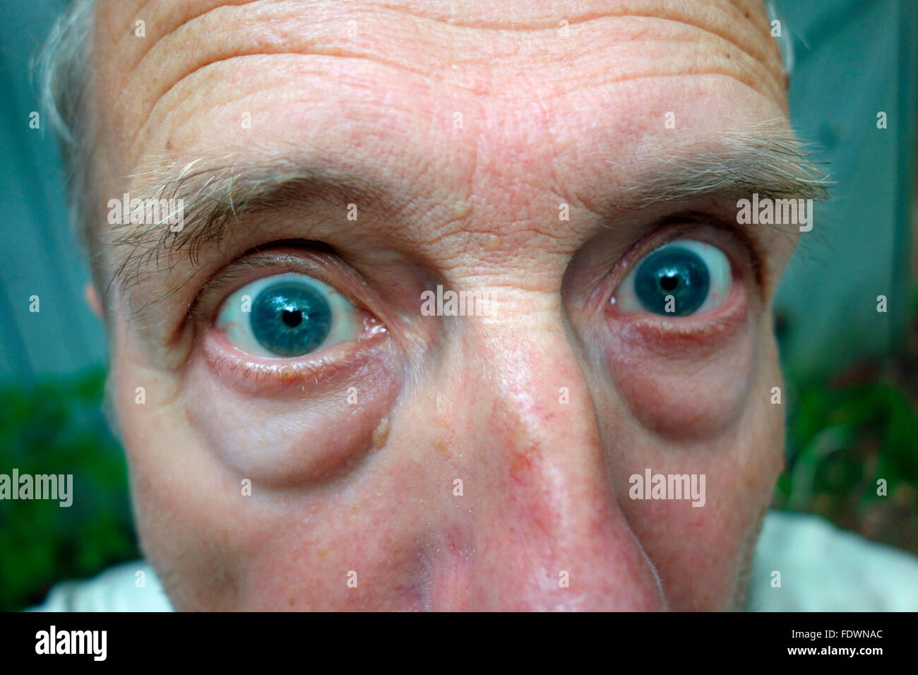 Ein lustiger Mensch Gesicht mit weit aufgerissenen Augen Stockfoto